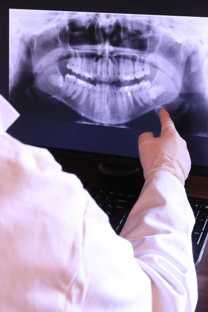 Best Emergency Tooth Extraction in Redwater, TX